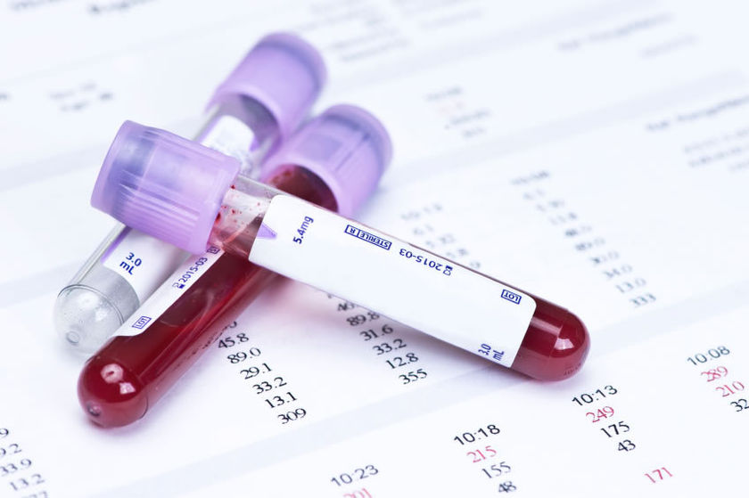 Μάθε να διαβάζεις τις αιματολογικές σου εξετάσεις. Τι σημαίνει κάθε μέτρηση;